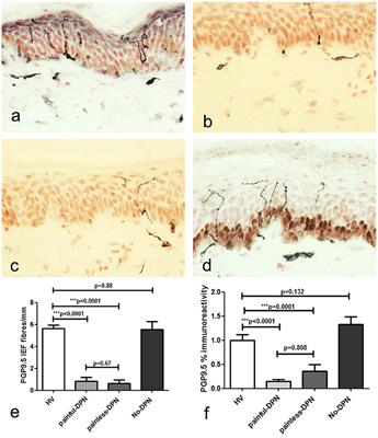 Nerve and Vascular Biomarkers in Skin Biopsies Differentiate Painful From Painless Peripheral Neuropathy in Type 2 Diabetes